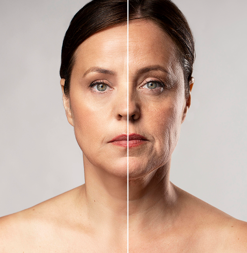 before and after portrait of a mature woman retouched