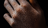 closeup darkskinned hand with small brown spots