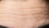 closeup view wrinkles pores forehead