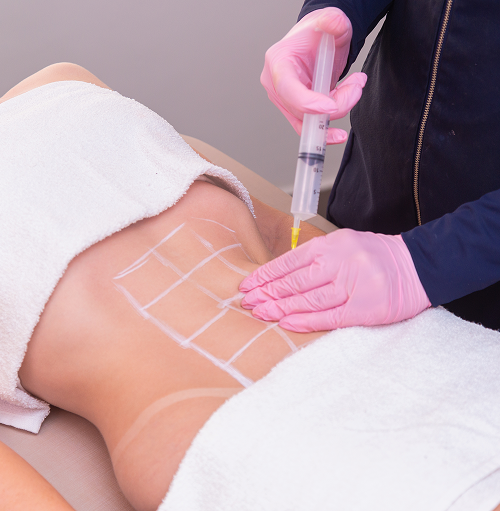 doctor injecting woman’s belly
