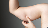fat woman cellulite arm belly unhealthy