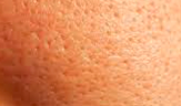 uneven texture