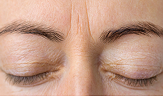 woman face skin with frown lines